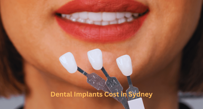 Dental Implants Cost in Sydney