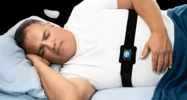 Obstructive Sleep Apnea