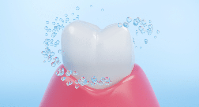 Regular Cleanings Are Essential for Avoiding Gum Disease