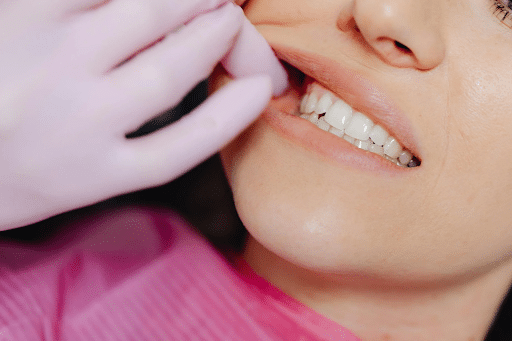 Regular Dental Care