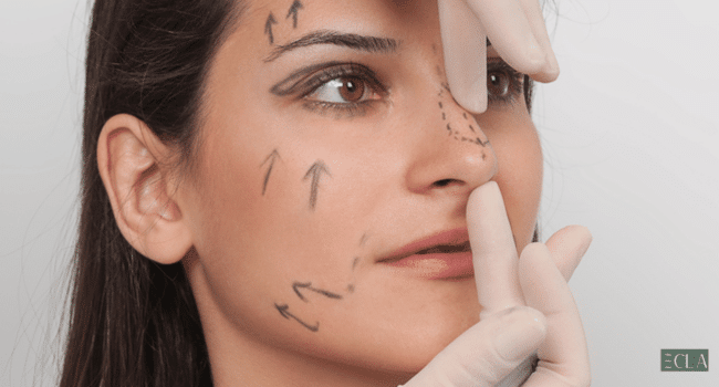 rhinoplasty in Dubai